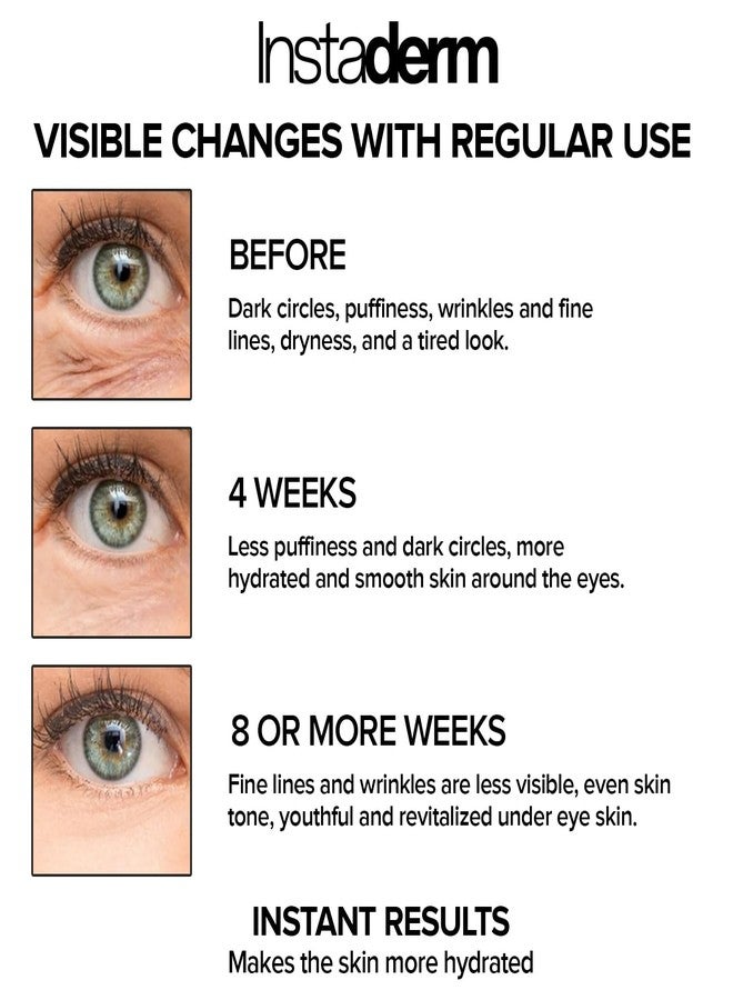 إنستاديرم كريم إنستاديرم لإصلاح منطقة العين - يقلل من ظهور الهالات السوداء والانتفاخات وأكياس تحت العين والخطوط الدقيقة والتجاعيد، تركيبة مضادة للشيخوخة مع النياسيناميد تعمل على تنعيم البشرة وتفتيحها وترطيبها بشكل واضح. - Image 5